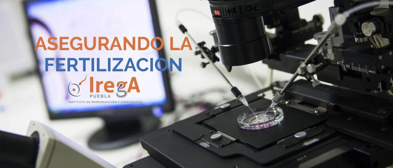 fertilización irega