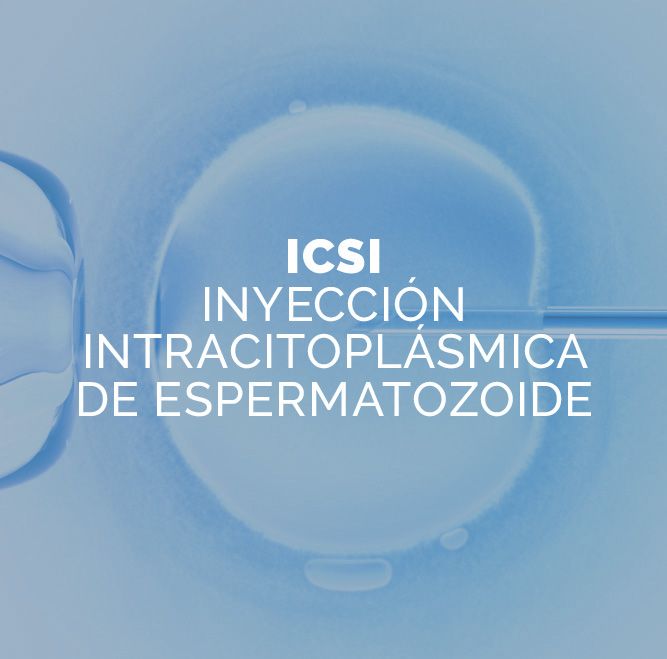ICSI