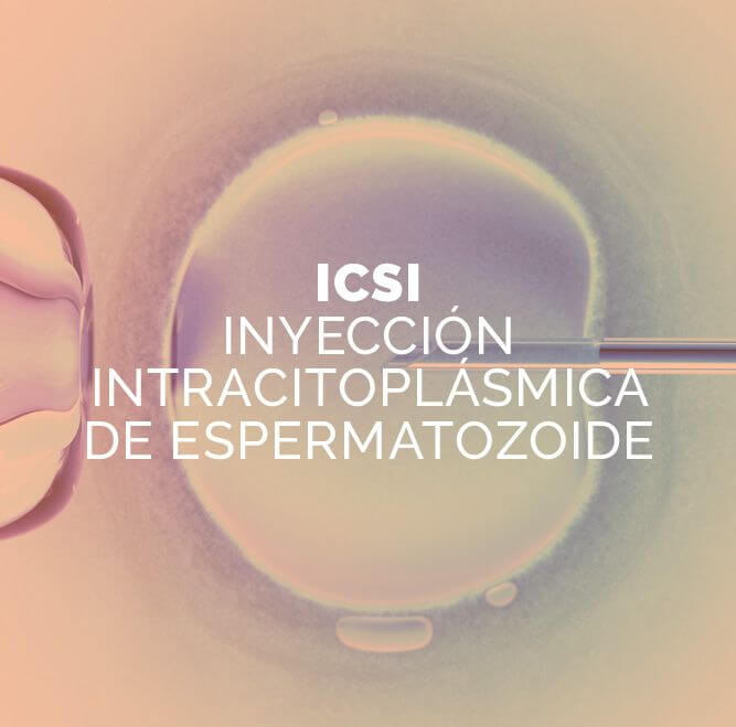 ICSI