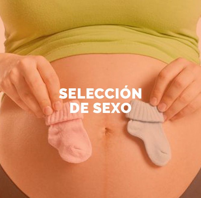 Selección del sexo